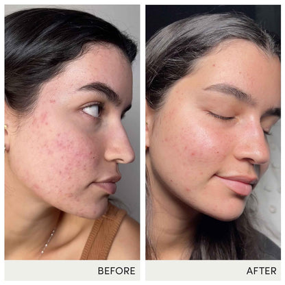 jane iredale Skin Accumax Nutritional Supplement Capsules Improve Acne & Promote Healthy Skin Contains Vitamin A, C and E Vegan & Gluten-Free
