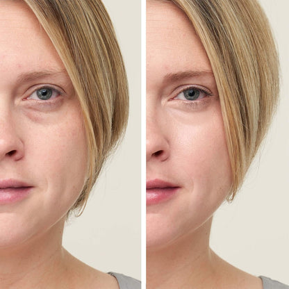 jane iredale CircleDelete Concealer | Creamy Under Eye Concealer with Vitamins A, C & E | Diminishes Appearance of Dark Circles & Softens Fine Lines