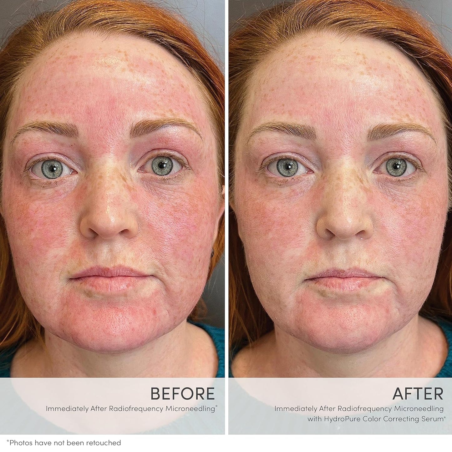 jane iredale HydroPure Tinted Serum, Hydrating, Sheer-Coverage Formula Helps Plump, Soothe, Blur Lines and Even Skin Tone with Hyaluronic Acid + CoQ10