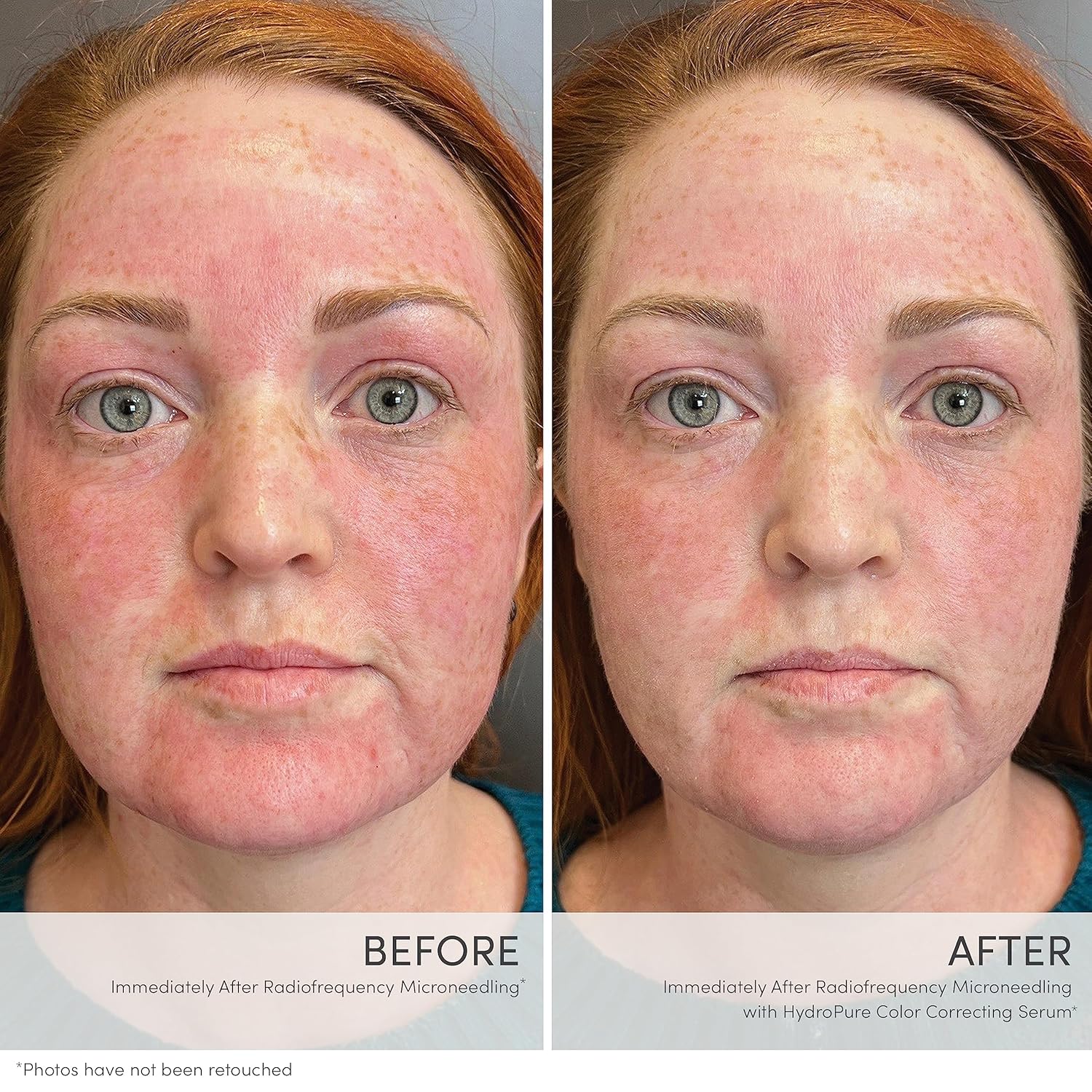 jane iredale HydroPure Tinted Serum, Hydrating, Sheer-Coverage Formula Helps Plump, Soothe, Blur Lines and Even Skin Tone with Hyaluronic Acid + CoQ10