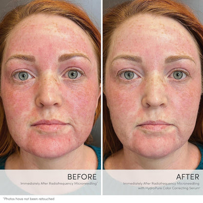 jane iredale HydroPure Tinted Serum, Hydrating, Sheer-Coverage Formula Helps Plump, Soothe, Blur Lines and Even Skin Tone with Hyaluronic Acid + CoQ10